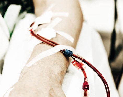 blood tubes coming out from the arm during dialysis